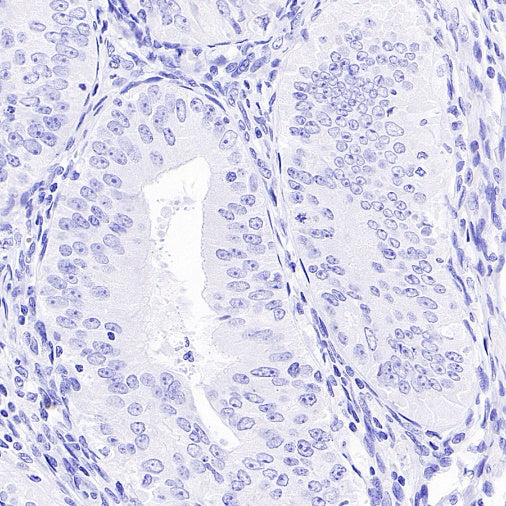 TdT Recombinant Mouse mAb (SDT-4203)
