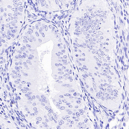 TdT Recombinant Mouse mAb (SDT-4203)