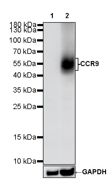 CCR9 Recombinant Rabbit mAb (S-2555-73)