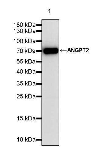 ANGPT2 Recombinant Rabbit mAb (S-1768-2)