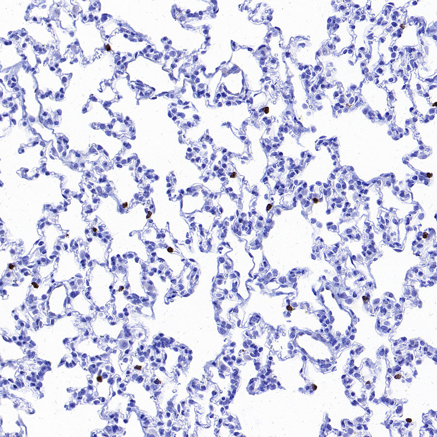 MMP9 Recombinant Rabbit mAb (S-3915-36)