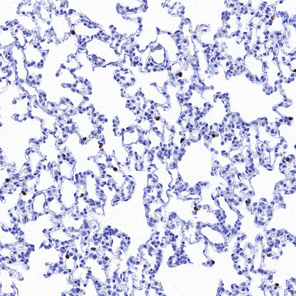 MMP9 Recombinant Rabbit mAb (S-3915-36)