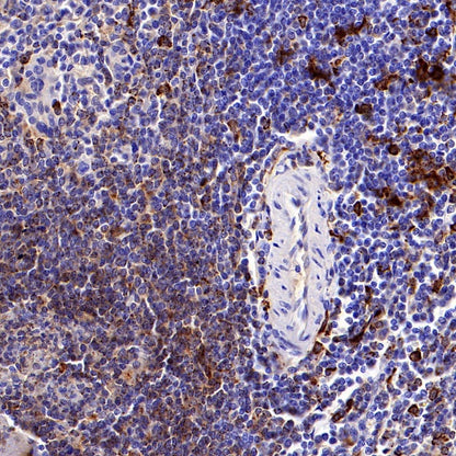 HLA-DRB1 Recombinant Rabbit mAb (SDT-R253)