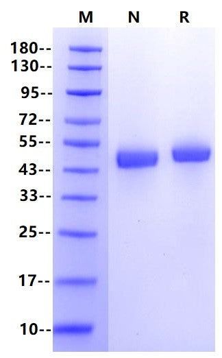 ACPP/ACP3  His Tag Protein, Human
