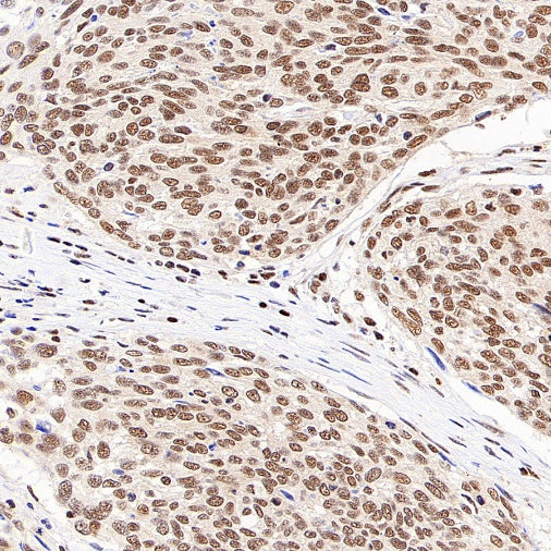 NR1D1 + NR1D2 / RVR Recombinant Rabbit mAb (S-5962)