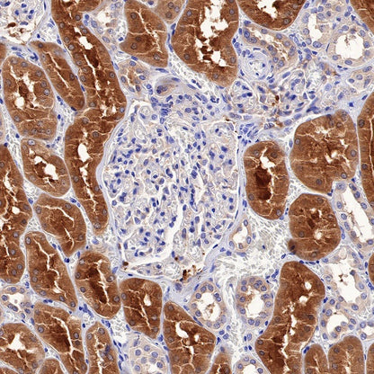 S-RMab®HDAC6 Recombinant Rabbit mAb (S-R338)