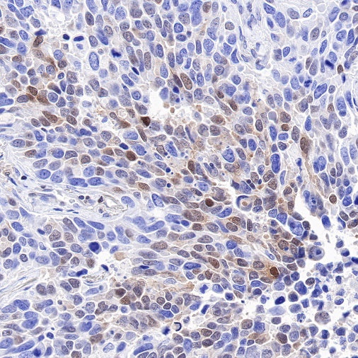 p27 Recombinant Rabbit mAb (SDT-R350)