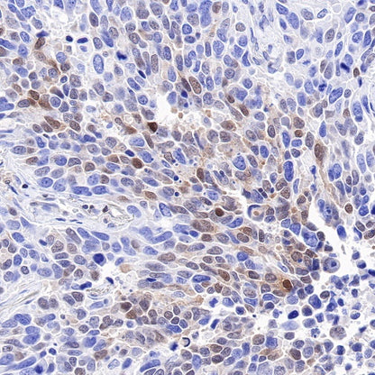 p27 Recombinant Rabbit mAb (SDT-R350)