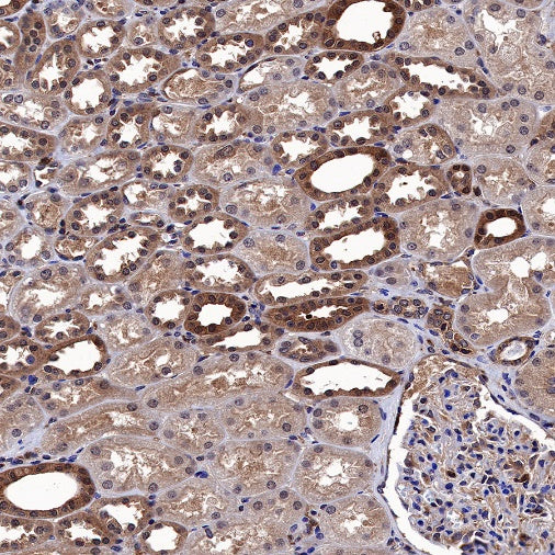 MEK1/2 Recombinant Rabbit mAb (S-834-101)