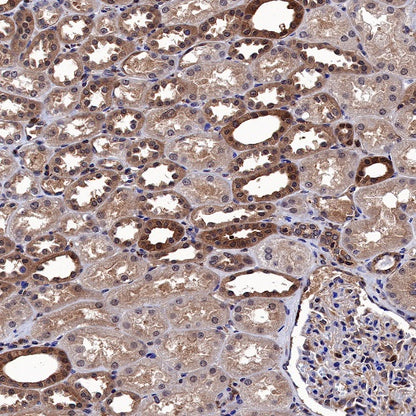 MEK1/2 Recombinant Rabbit mAb (S-834-101)
