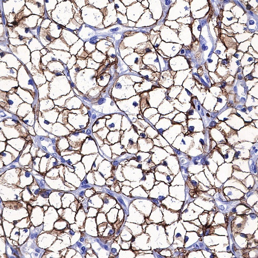 Carbonic Anhydrase 9 Recombinant Rabbit mAb (SDT-733-28)
