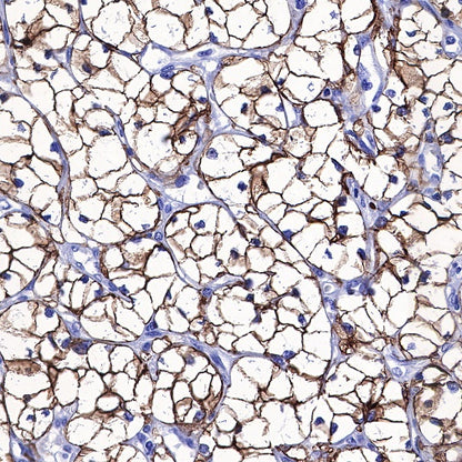 Carbonic Anhydrase 9 Recombinant Rabbit mAb (SDT-733-28)