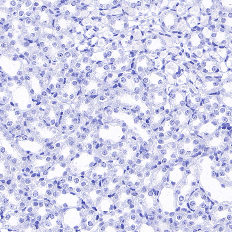 pan SCN Recombinant Rabbit mAb (S-5038)