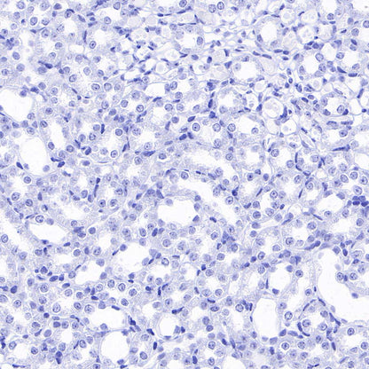pan SCN Recombinant Rabbit mAb (S-5038)