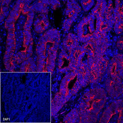 E-Cadherin Recombinant Rabbit mAb (Alexa Fluor® 555 Conjugate) (S-438-5)