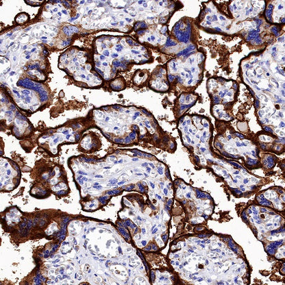 VISTA Recombinant Rabbit mAb (S-1469-72)