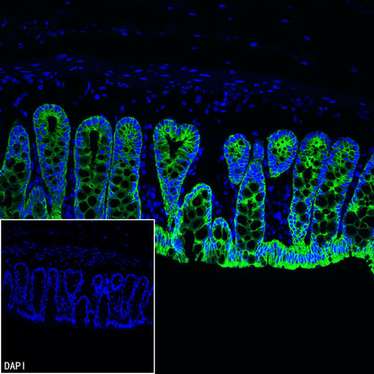 Cytokeratin 7 Recombinant Rabbit mAb (S-5954)