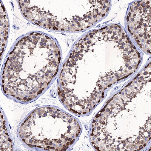 STIP1 Recombinant Rabbit mAb (S-680-39)