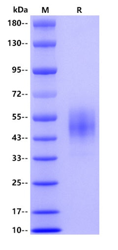 Fc γ RIa/CD64 His Tag Protein, Human