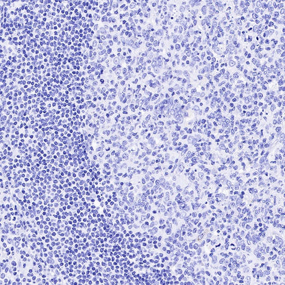 PLAP+ALPI Recombinant Rabbit mAb (SDT-167-155)