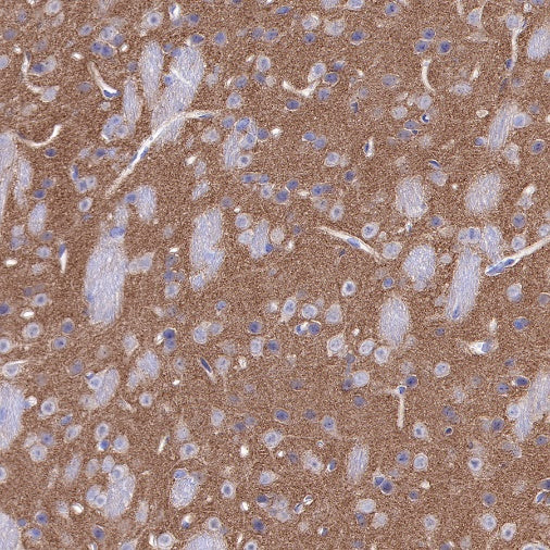 α-Synuclein Recombinant Rabbit mAb (S-441-86)