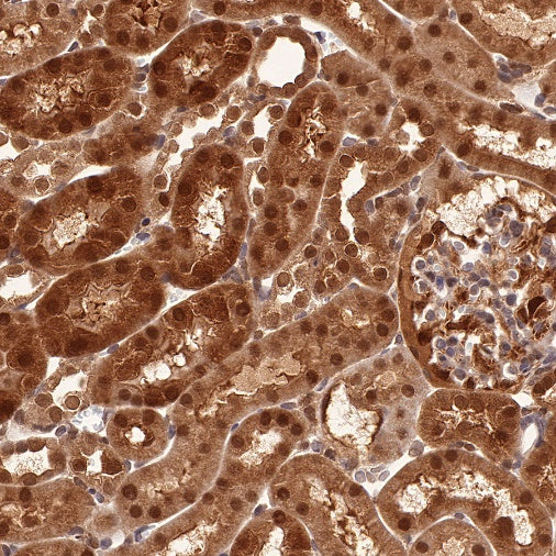 SBDS Recombinant Rabbit mAb (S-R344)