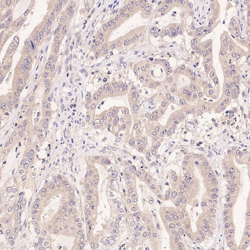 NEK7 Recombinant Rabbit mAb (S-2494-70)