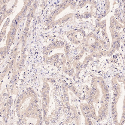 NEK7 Recombinant Rabbit mAb (S-2494-70)