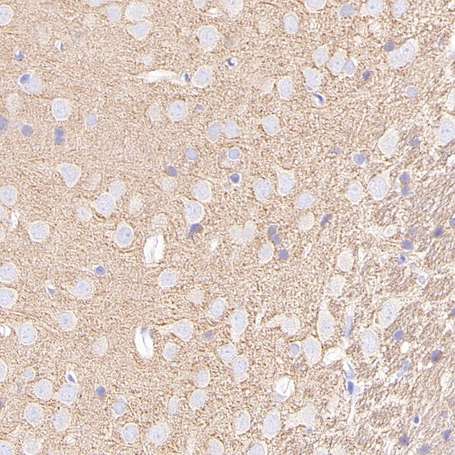 Beta II tubulin Recombinant Rabbit mAb (S-1055-2)