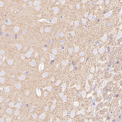 Beta II tubulin Recombinant Rabbit mAb (S-1055-2)