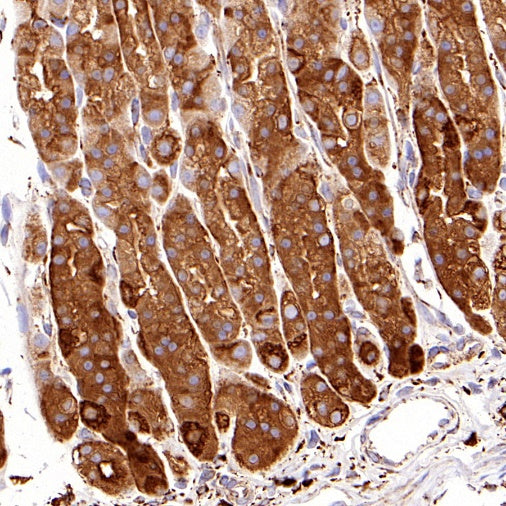 GRP94 Recombinant Rabbit mAb (S-R268)