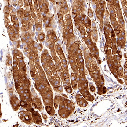 GRP94 Recombinant Rabbit mAb (S-R268)