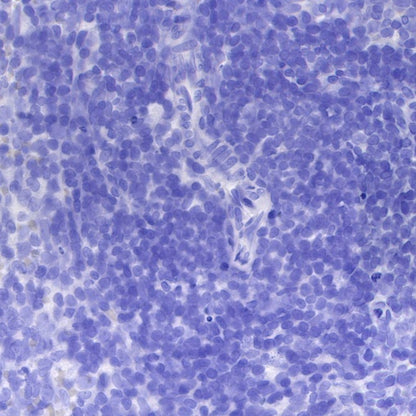 Synapsin-1 Recombinant Rabbit mAb (S-550-7)