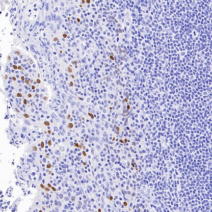 FOXA1 Recombinant Rabbit mAb, PBS Only  (SDT-2779-17)