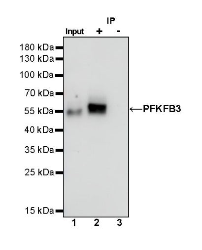 PFKFB3 Recombinant Rabbit mAb (S-653-35)