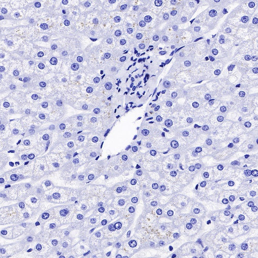 Pan Trk Recombinant Rabbit mAb (SDT-400-39)