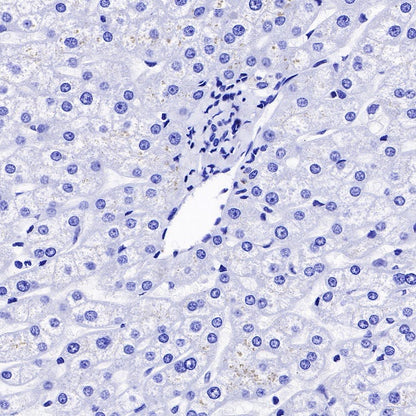 Pan Trk Recombinant Rabbit mAb (SDT-400-39)