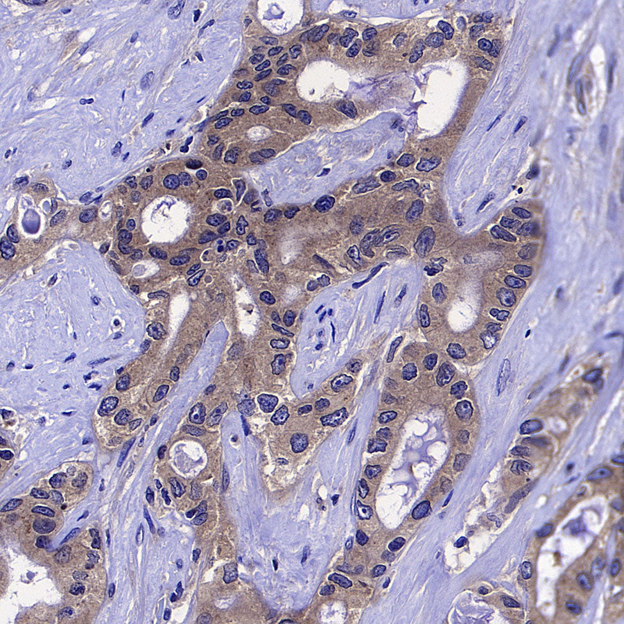 COPZ1 Recombinant Rabbit mAb (S-4445-53)