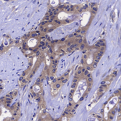 COPZ1 Recombinant Rabbit mAb (S-4445-53)