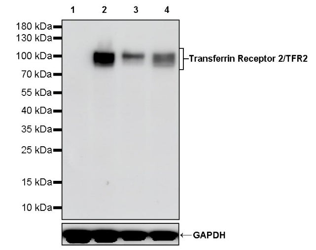 Transferrin Receptor 2/TFR2 Recombinant Rabbit mAb (S-1735-133)