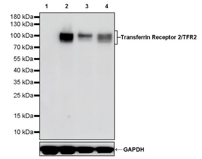 Transferrin Receptor 2/TFR2 Recombinant Rabbit mAb (S-1735-133)