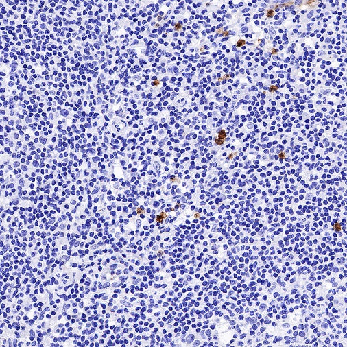 CXCR2 Recombinant Rabbit mAb (S-1292-30)