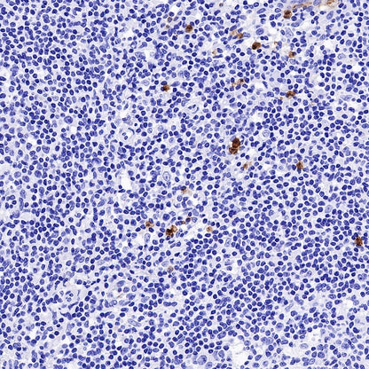 CXCR2 Recombinant Rabbit mAb (S-1292-30)