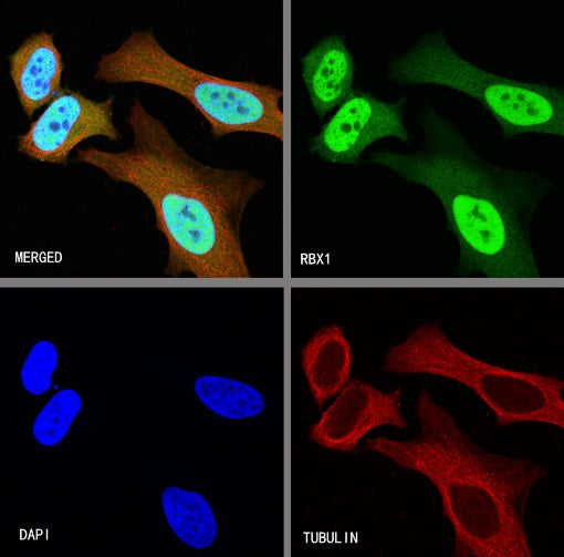 RBX1 Recombinant Rabbit mAb (S-R355)