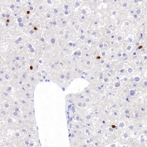 Neutrophil Elastase (ELA2) Recombinant Rabbit mAb (S-3766-3)