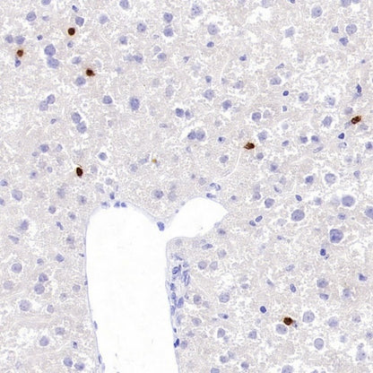 Neutrophil Elastase (ELA2) Recombinant Rabbit mAb (S-3766-3)