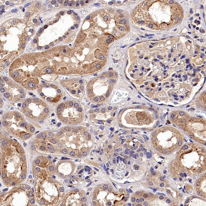 TYK2 Recombinant Rabbit mAb (S-2740-165)