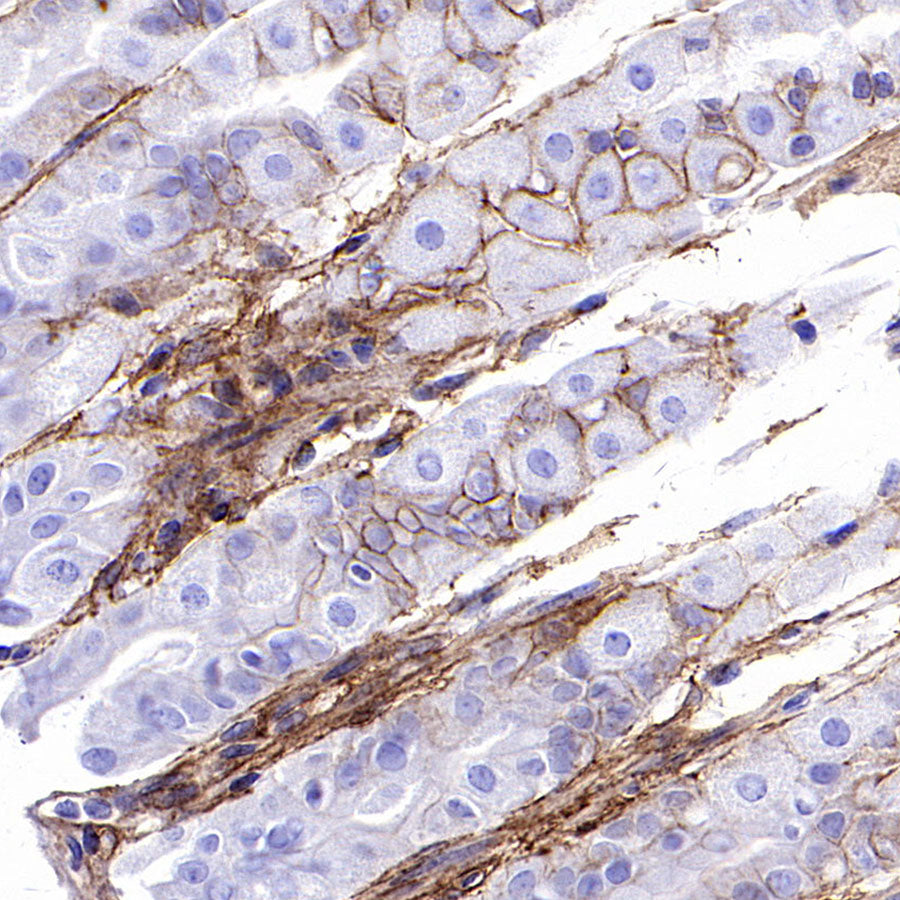 PTK7 Recombinant Rabbit mAb ,PBS Only(SDT-2432-136)