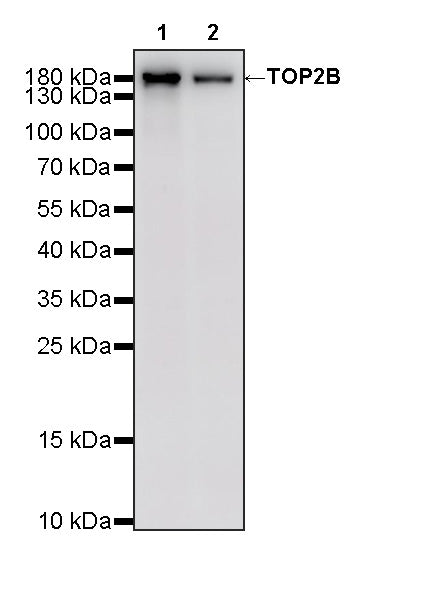TOP2B Recombinant Rabbit mAb (S-4452-44)