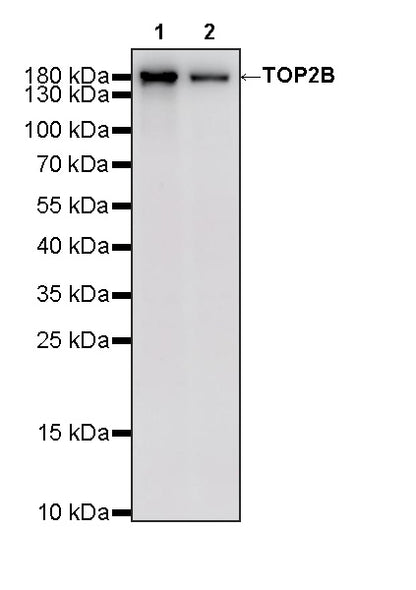 TOP2B Recombinant Rabbit mAb (S-4452-44)